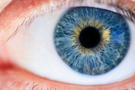 La iridotomía se hace en el iris