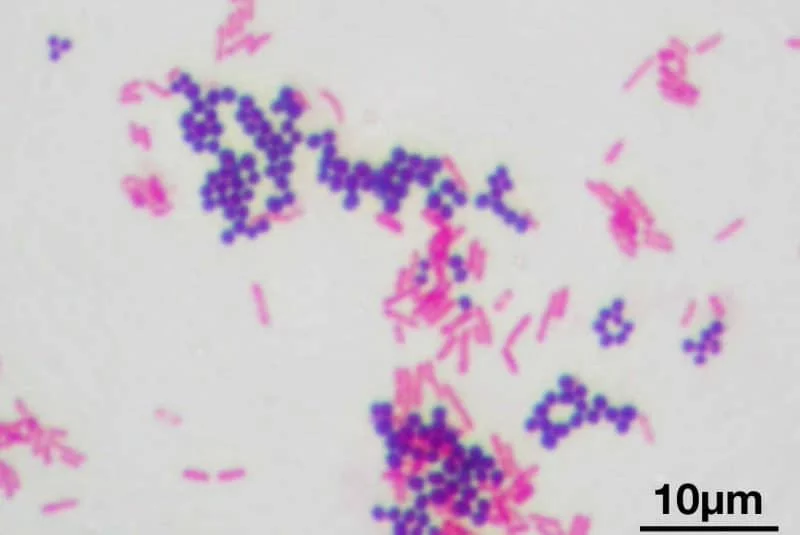 Tinción de Gram Staphylococcus aureus y Escherichia coli