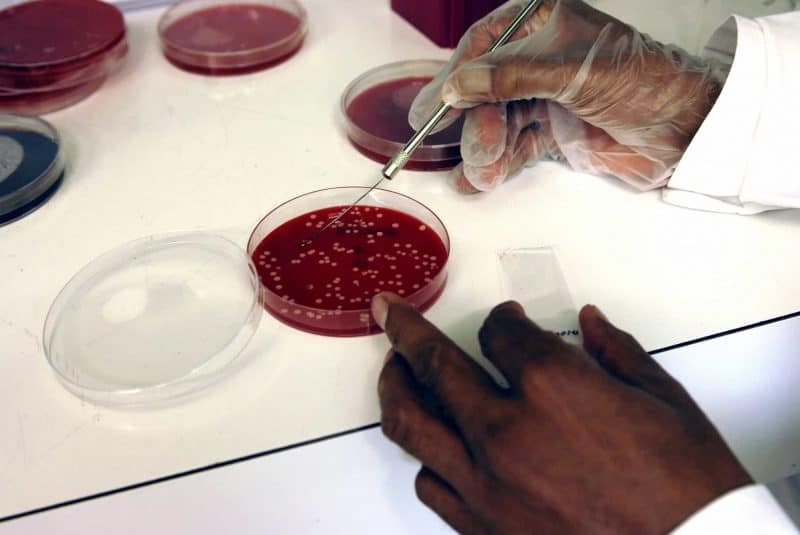 Colonias bacterianas contaminan muestra de sangre