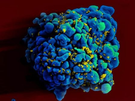 Linfocito TH9 atacado por el VIH