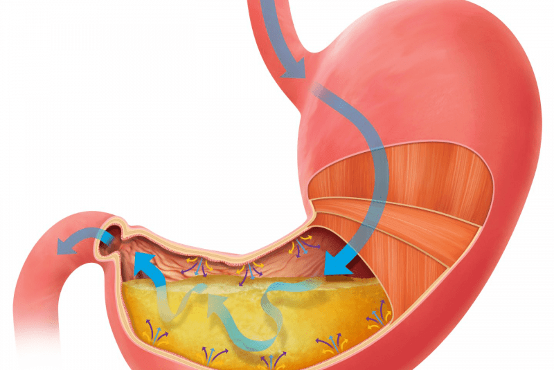 Ilustración estómago com ácido