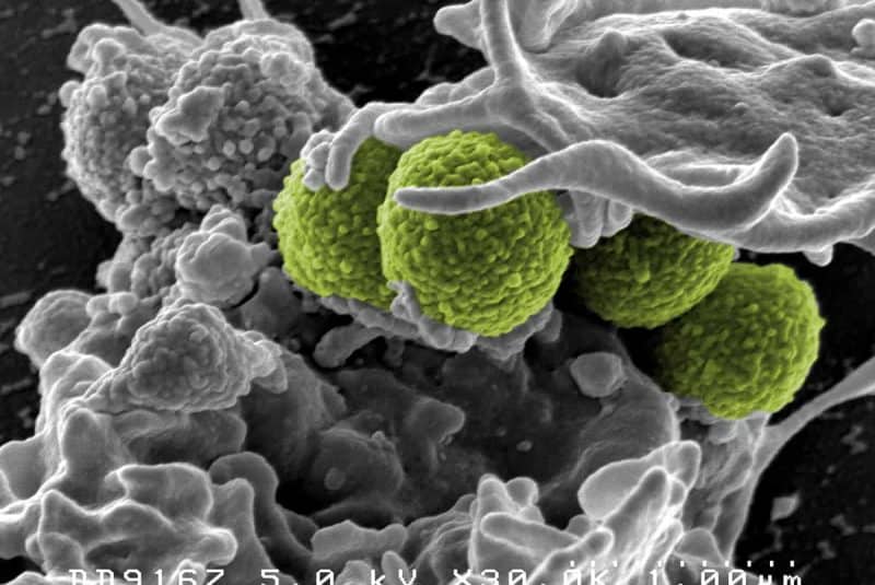 Staphylococcus aureus resistente a la meticilina