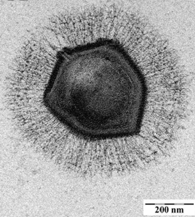 Microscopía electrónica de Mimivirus