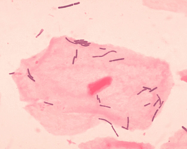 Lactobacillus sp (vagina)