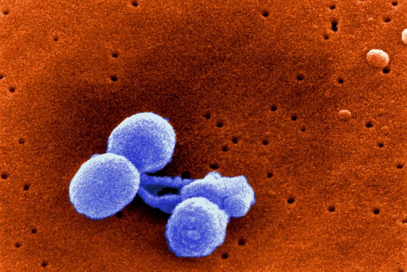 Streptococcus pneumoniae es la causa más frecuente de meningitis bacterianas