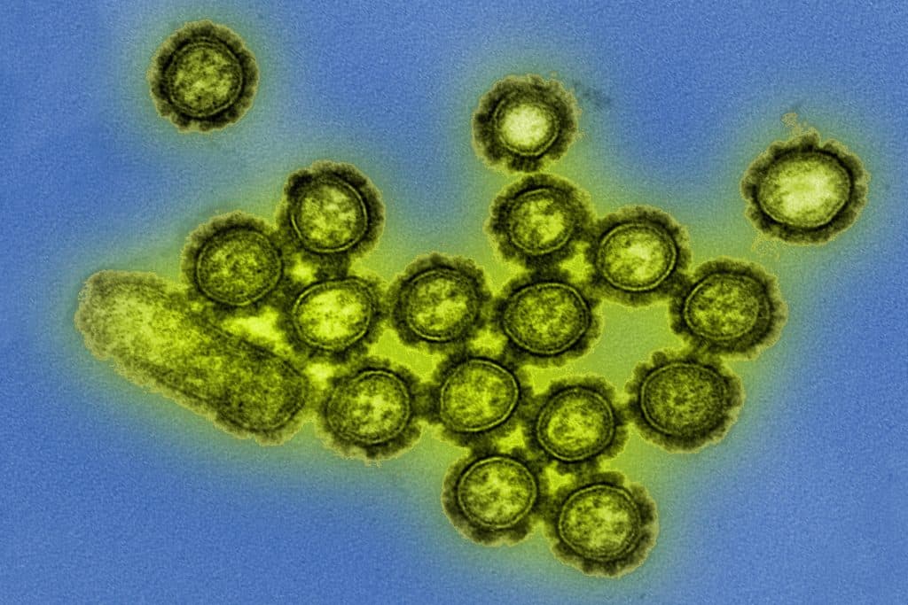 Partículas de virus influeza H1N1