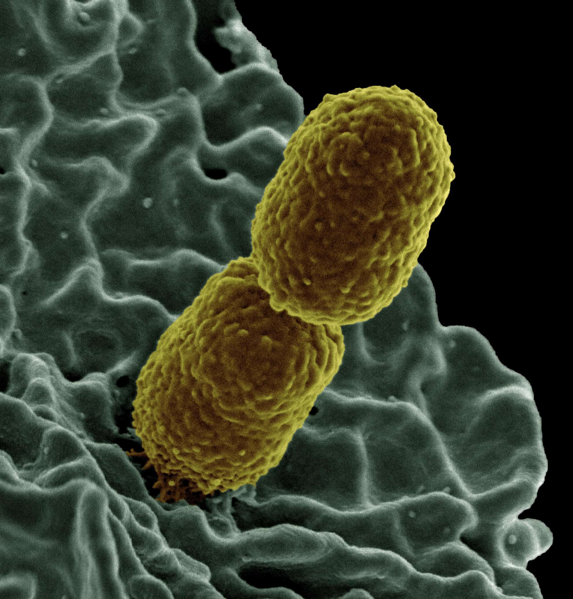 Resultado de imagen para enterobacterias