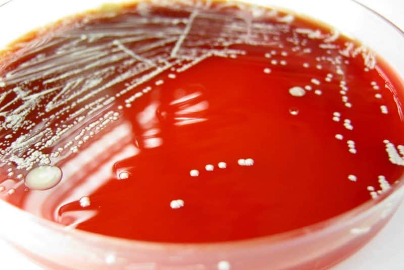 Placa petri con cultivo bacteriano (Propionibacterium acnes)