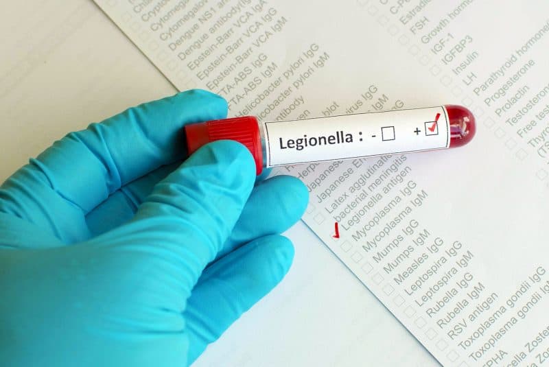 Test de antígeno legionelosis