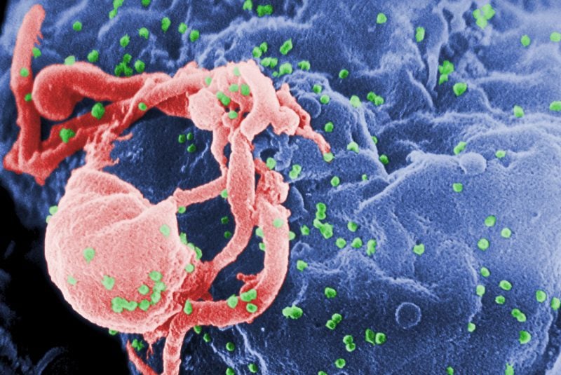 VIH liberándose de un linfocito