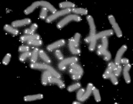 Telómeros al microscopio con marcadores fluorescentes