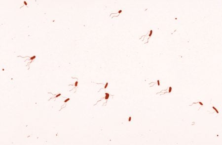 Bordetella bronchiseptica, una betaproteobacteria flagelada