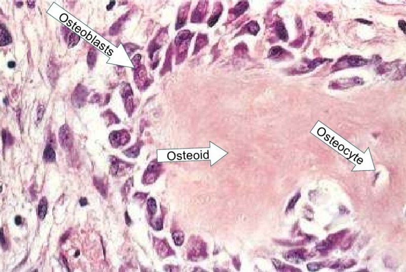 Osteoblastos, osteocitos y osteoide