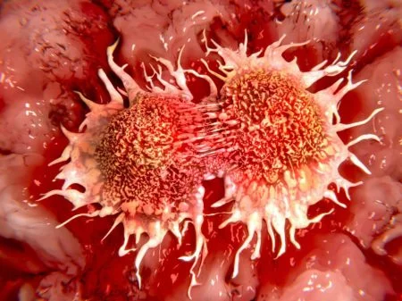 Células cancerosas en división